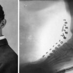 Nikola Tesla Made an X-Ray of His Own Foot With a Machine He Designed in 1896