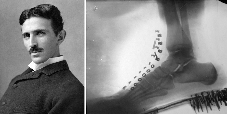 Nikola Tesla Made an X-Ray of His Own Foot With a Machine He Designed in 1896